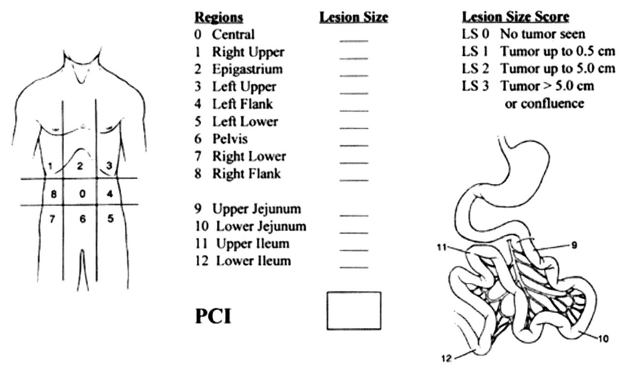 Peritoneal cancer index( pci), Peritoneal cancer index (pci). 2Indexul Peritoneal Al Cancerului